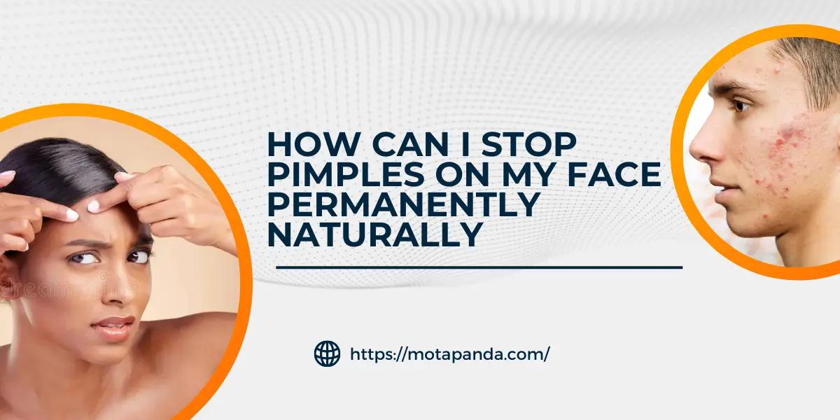 How can i stop pimples on my face permanently naturally